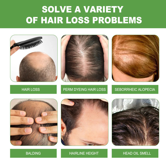 Rosemary Hair Shampoo Scalp Cleaning Effective Straighten Nourish Roots Relieve Itch Reduce Dandruff Promote Hair Growth Product